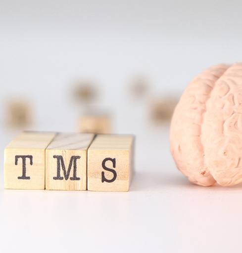 tms therapy 2